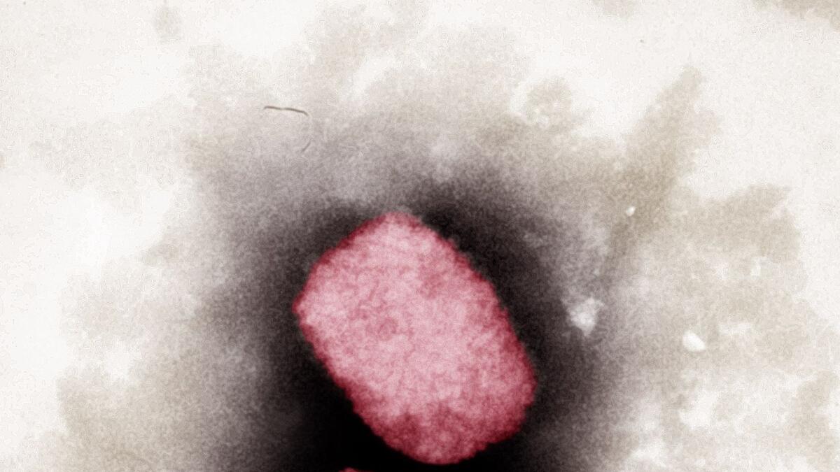UAE announces 3 new cases of monkeypox