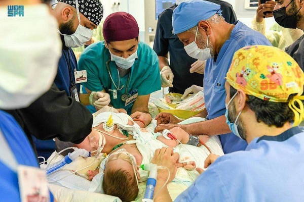 Separation surgery for Yemeni conjoined twins begins in Riyadh