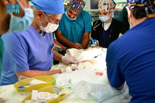 Saudi conjoined twins successfully separated